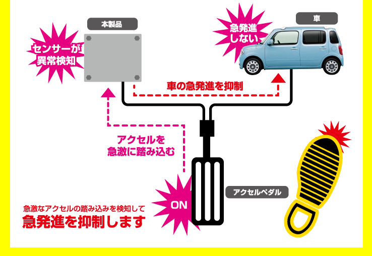 アクセルの踏み間違え・急発進を防止！「後付け安全装置」みなさんは